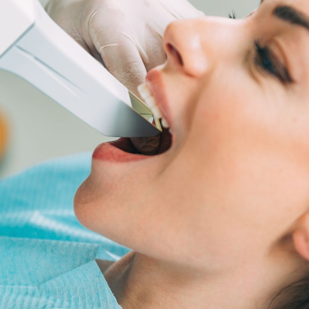 faccette dentali a Novi Ligure