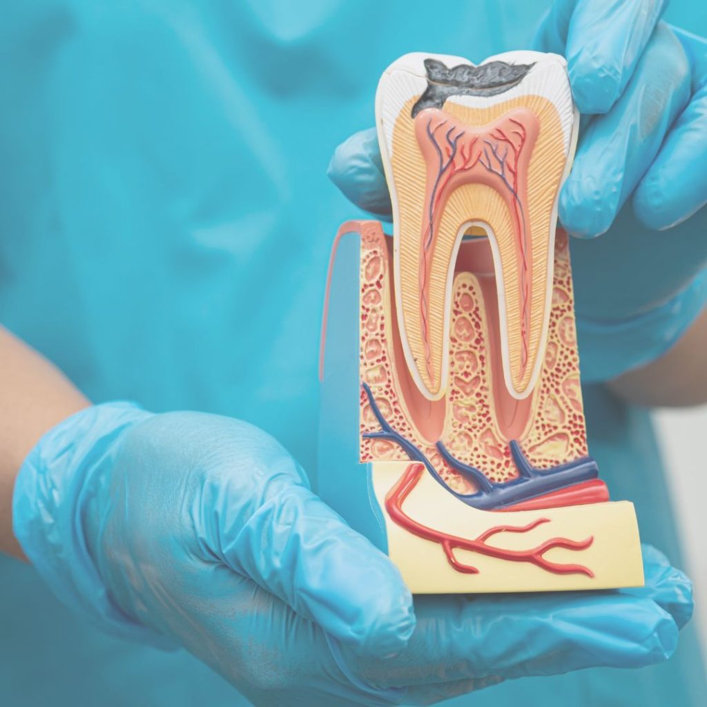 devitalizzazione dente a Novi Ligure