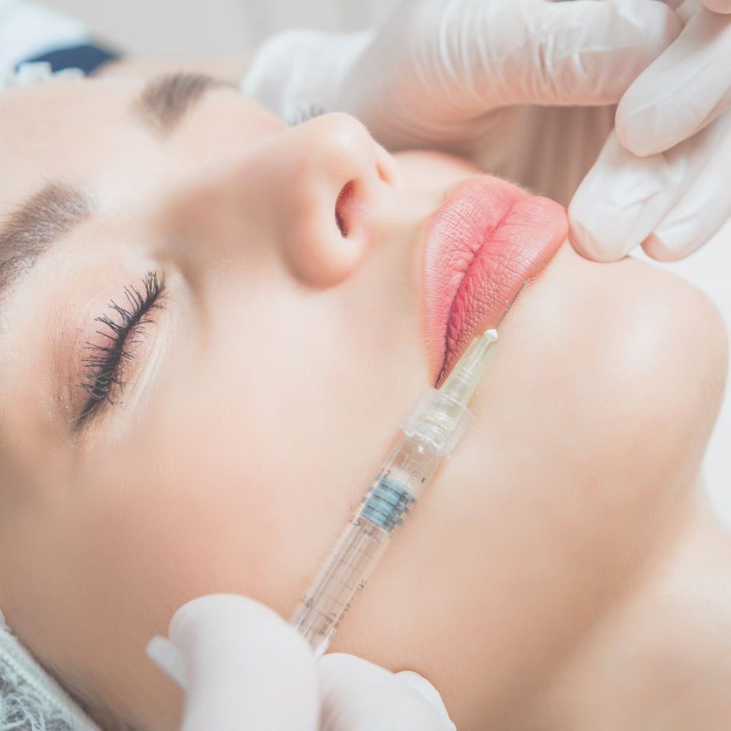 filler labbra a Novi Ligure